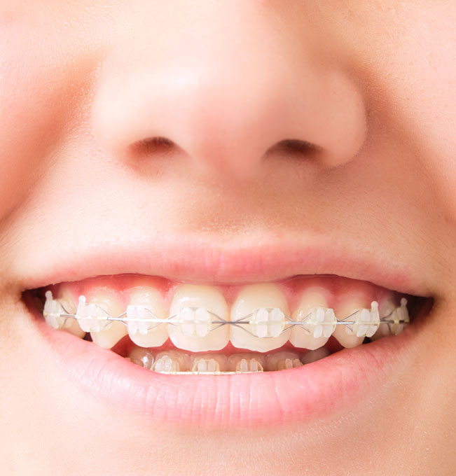 Revolutionizing-Orthodontic-Care.jpg