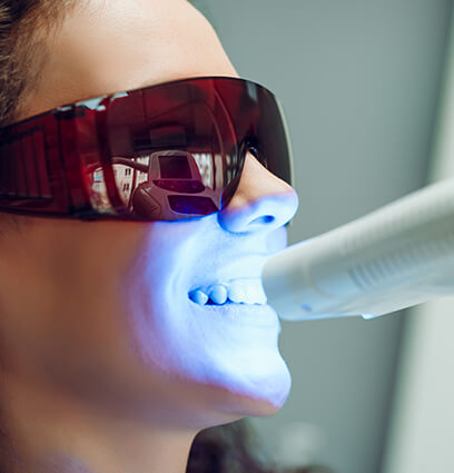 Gum recontouring