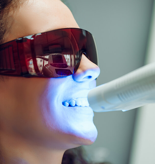 Am I a candidate for teeth whitening? Am I a candidate for teeth whitening?
